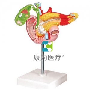 “康為醫療”病理模型胰腺模型，十二指腸和膽囊模型