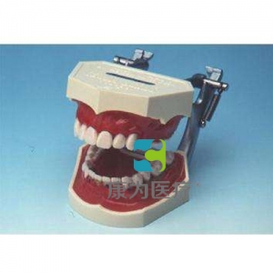 “康為醫療”牙周病模型（治療中）