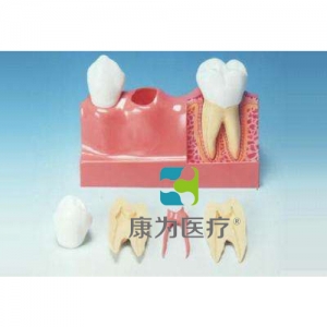 “康為醫療”牙分解模型(4倍大)